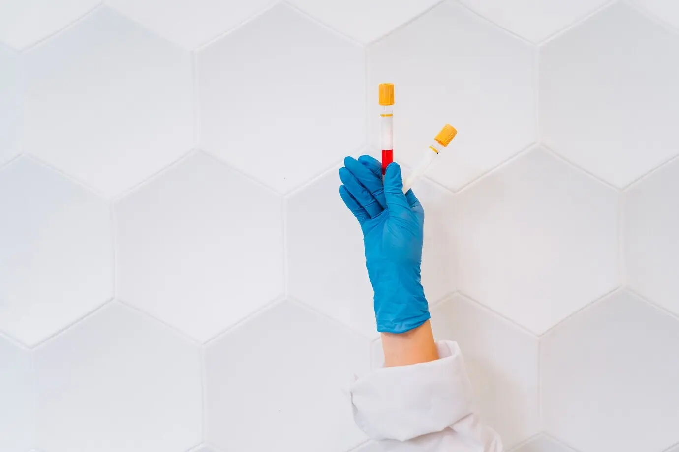 Una mano con guante de goma sostiene dos tubos con el medicamento.